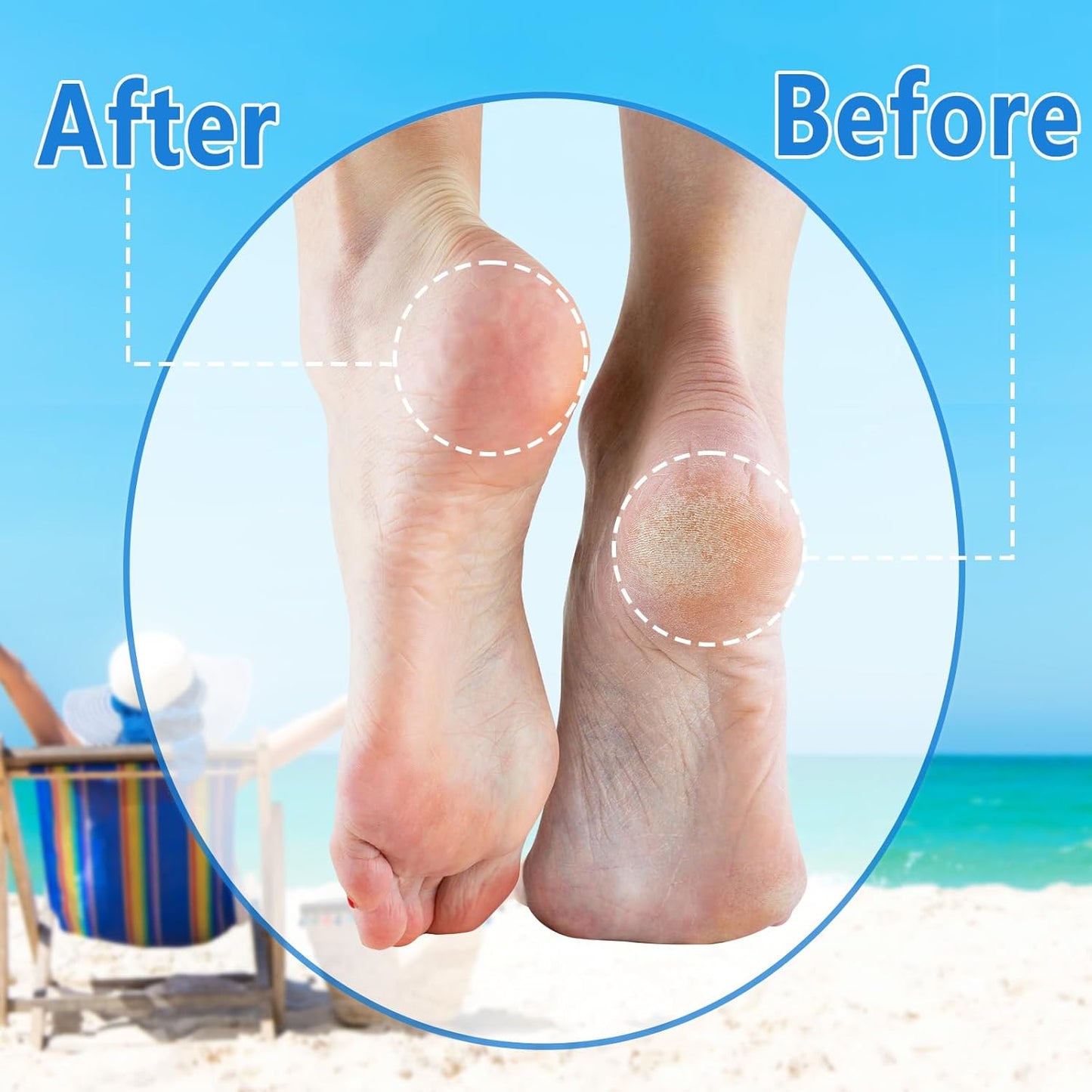Foot File Callus Remover for Feet, Electric Foot Callus Remover Pedicure Kit, Rechargeable Feet Care Professional Tool for Dry Skin Dead Hard Cracked Ideal Gift